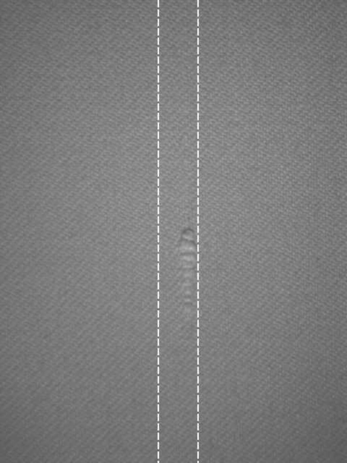 Cyclops defect_Herstelde Ketting